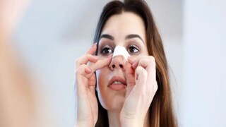 ব্ল্যাকহেডস দূর করার উপায় ব্ল্যাকহেডস দূর করার উপায়