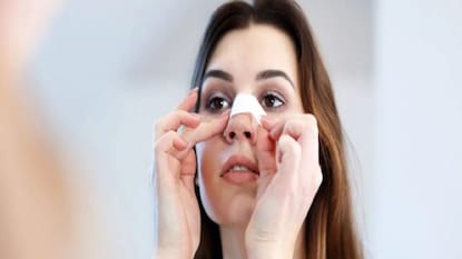 ব্ল্যাকহেডস দূর করার উপায় ব্ল্যাকহেডস দূর করার উপায়