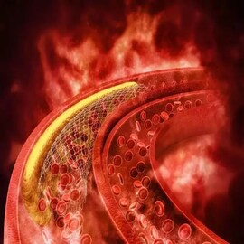 সতর্ক থাকুন! শরীরে কোলেস্টেরল বাড়লে পায়ে দেখা দেয় এই বিপজ্জনক লক্ষণগুলি...