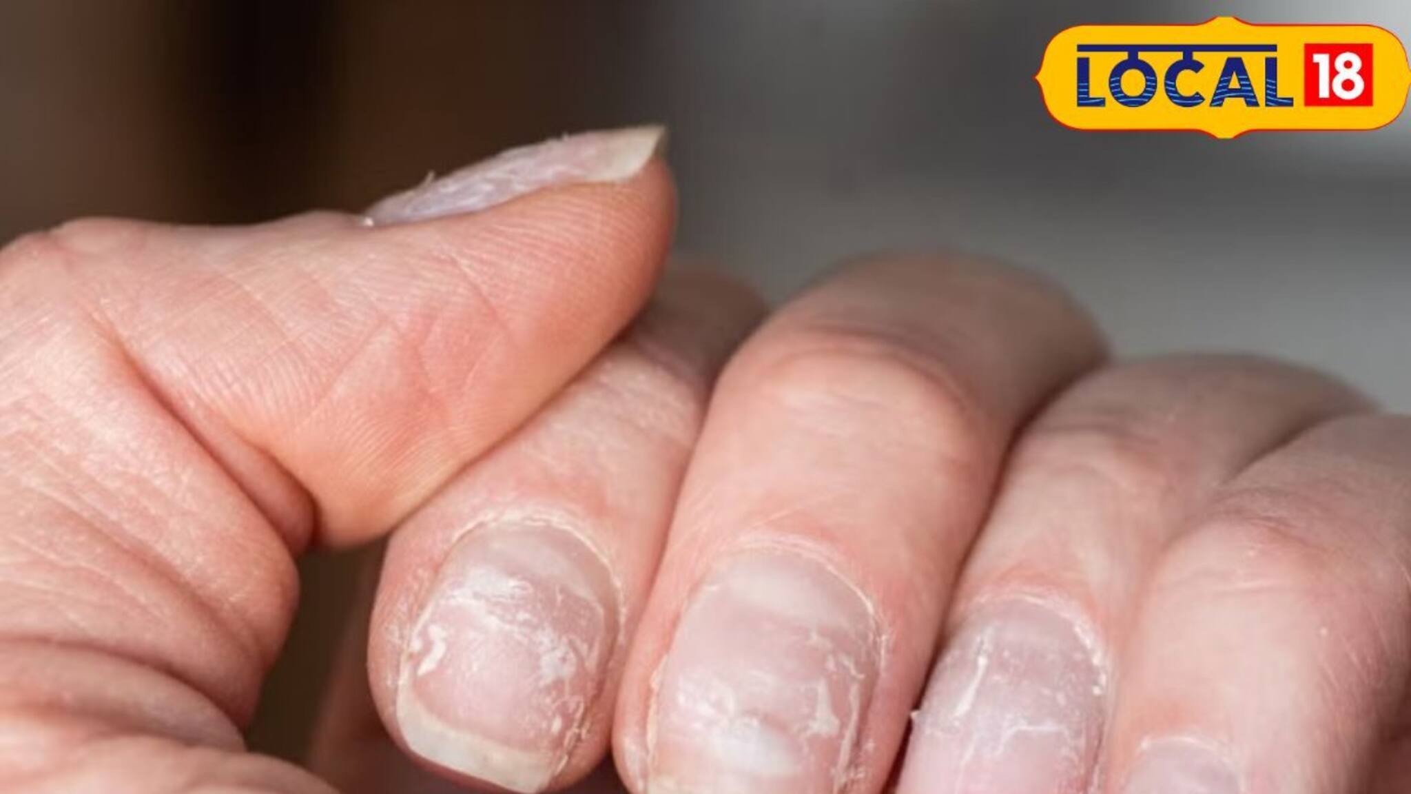 লাল-বেগুনি নখেই সর্বনাশ! নেলপলিশের রঙিন মোহেই লুকিয়ে মারাত্মক 'বিষ'! কতটা ক্ষতিকর জানেন?