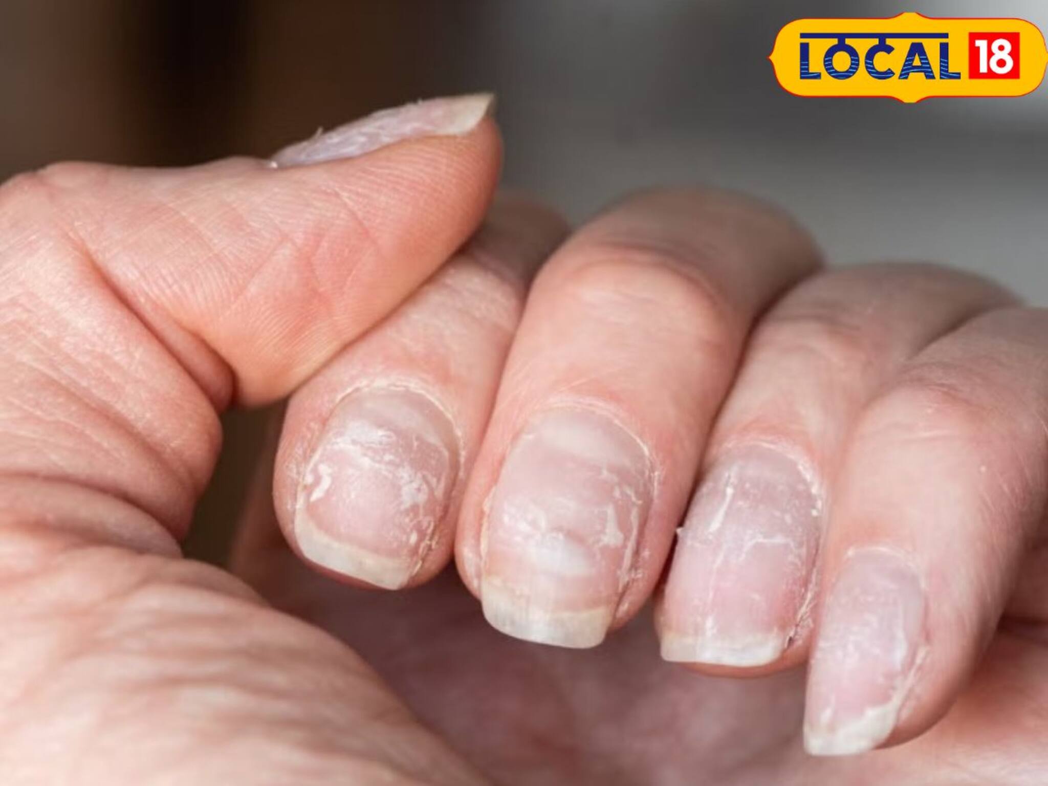 লাল-বেগুনি নখেই সর্বনাশ! নেলপলিশের রঙিন মোহেই লুকিয়ে মারাত্মক 'বিষ'! কতটা ক্ষতিকর জানেন?