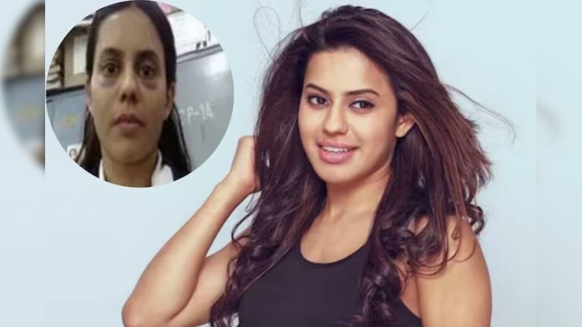 Ranya Rao: ভয়ঙ্কর ক্ষত মুখ! চোখের তলায় কালশিটে, শরীরে আঘাতের দাগ, কী হয়েছে রানিয়ার? জানলে শিউরে উঠবেন