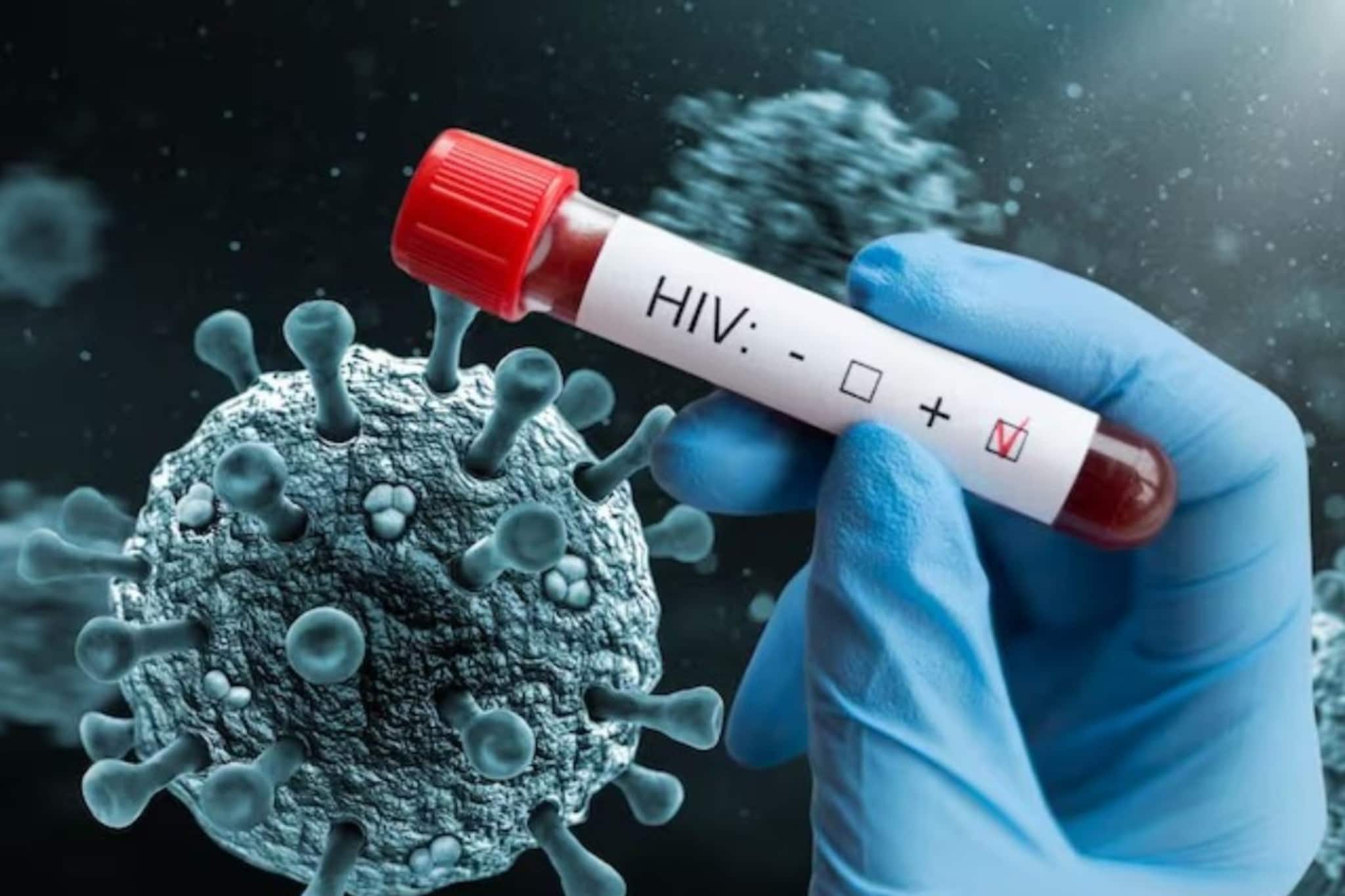 ৫০ বছরের পর হুরহুর করে বাড়ছে HIV আক্রান্তের সংখ্যা! বিপদ থেকে বাঁচার উপায় জানুন...