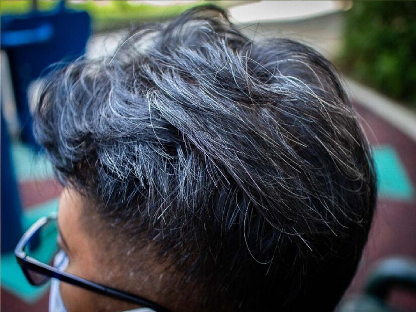 *সাদা চুল কালো করার জন্য অনেকেই রঞ্জকের পাশাপাশি বিভিন্ন ধরণের অন্যান্য পণ্য ব্যবহার করে। কিন্তু এই সব প্রোডাক্ট নানাভাবে চুলের ক্ষতি করে। এভাবে কাঁচা হলুদের এই প্যাক আপনার সাদা চুলকে কালো কয়লার মতো করে তুলতে পারে। সংগৃহীত ছবি। 