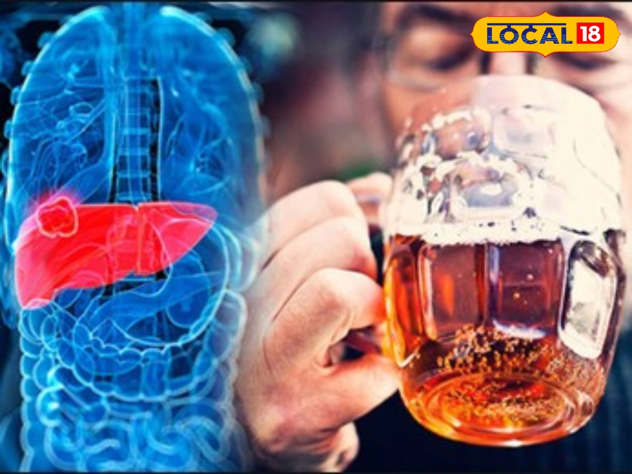 লিভারে জমে আছে দূষিত ‘টক্সিন’! ছেঁকে বার করার জন্য পাতে রাখুন এই কয়েকটা সাধারণ খাবার