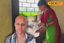 মাথায় চুল নেই, নেই পায়ের শক্তি! এই নারীর অসামান্য জীবন, কাহিনী জানলে অবাক হবেন