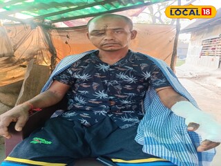 বাকি আক্রান্ত গণেশ শ্যামল