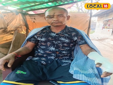 বাকি আক্রান্ত গণেশ শ্যামল