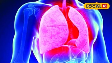 মুর্শিদাবাদের