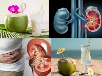 ডাবের জলে ১ চামচ এই বীজ! জমবে না কিডনিতে পাথর! কমবে ক্রিয়েটিনিন! প্রস্রাবের রোগে জাদু