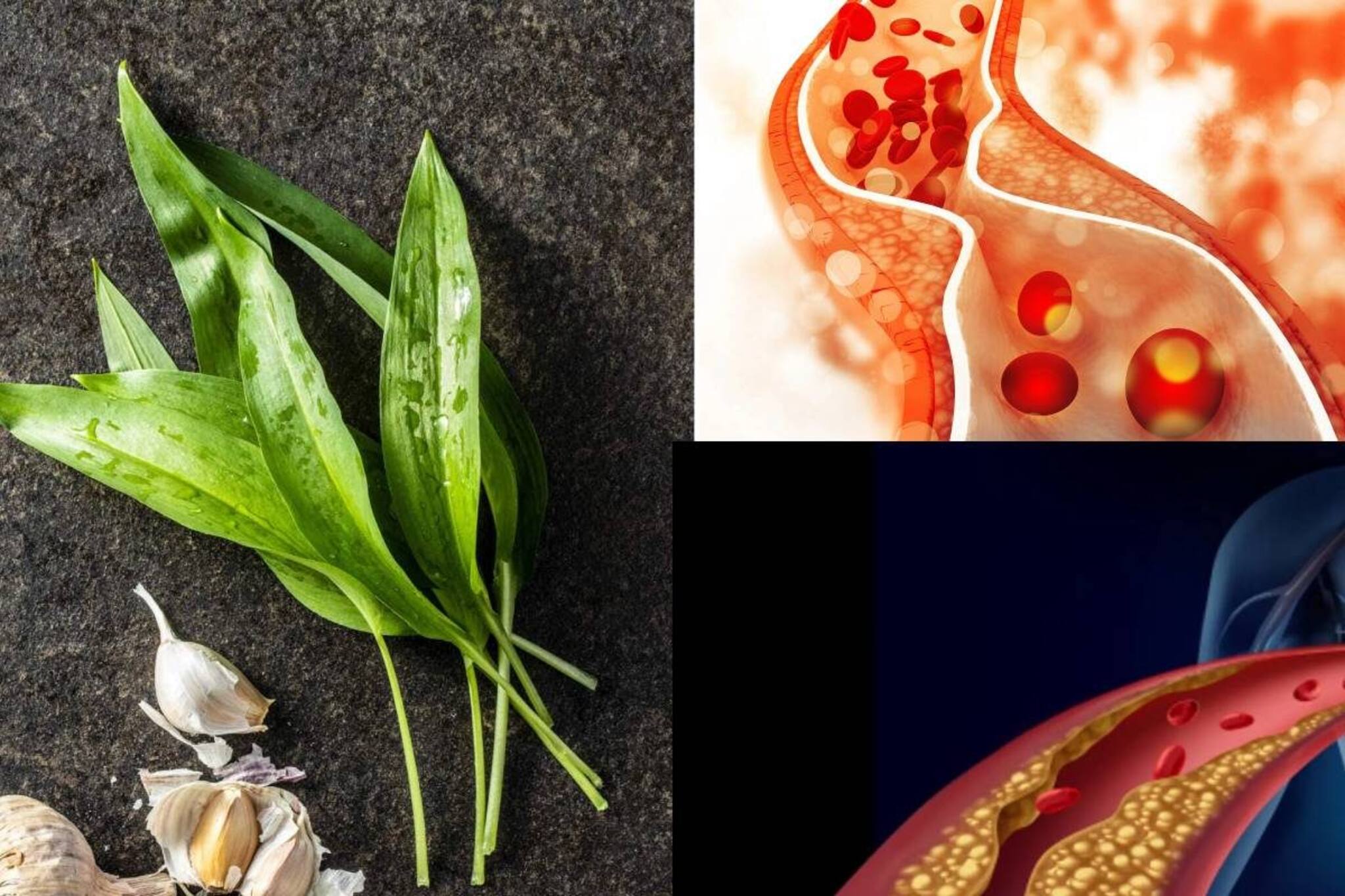 শুষে নেবে বদ কোলেস্টেরল! হার্টের রোগ পগারপার! শুধু এভাবে বানিয়ে খান এই পাতার চাটনি