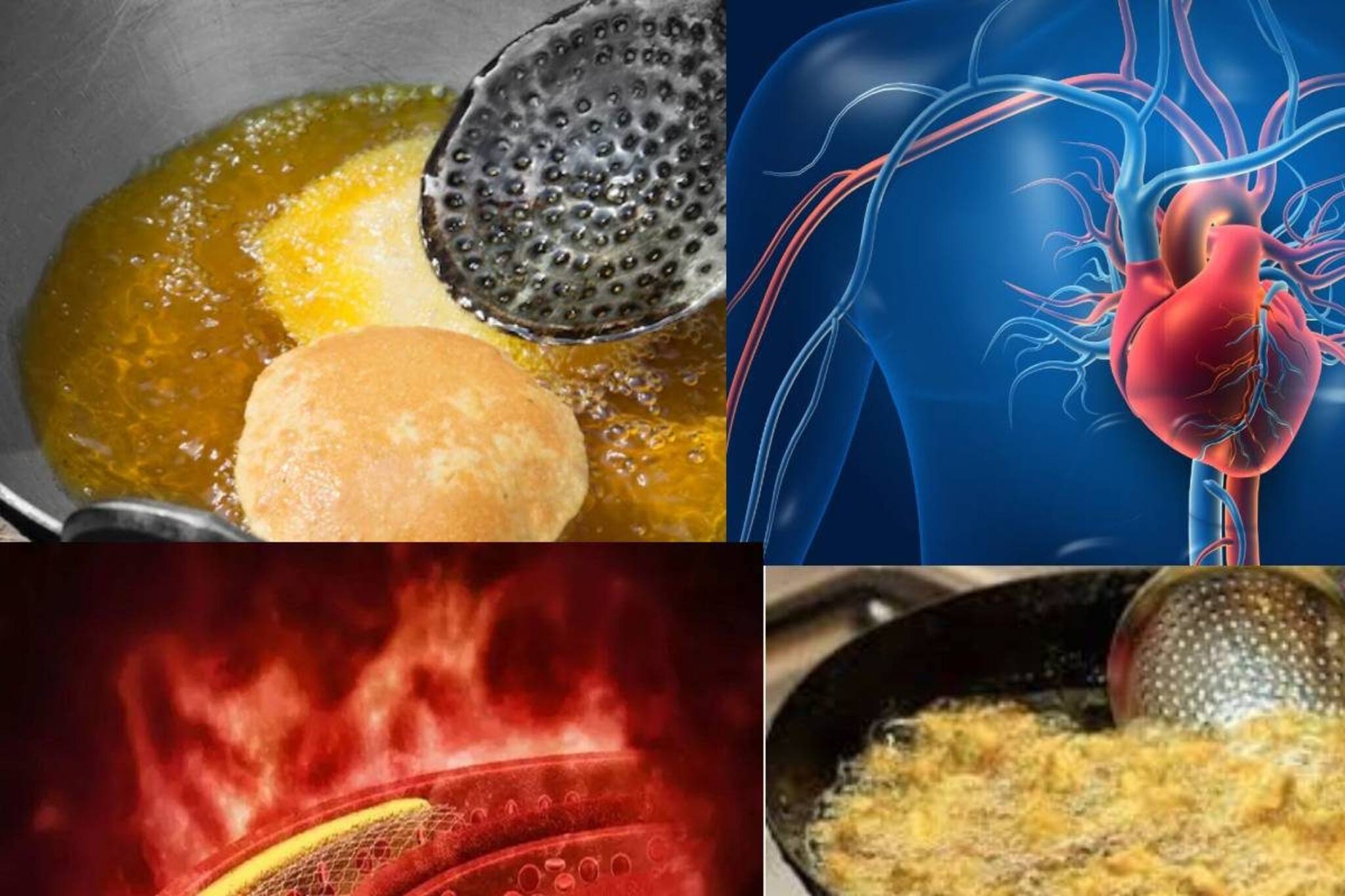 ‘কোলেস্টেরলের’ পুরু স্তর! ‘চর্বি’ জমবে হৃদযন্ত্রে! ‘এই বিশেষ তেলে’ রাঁধলে ঝাঁঝরা শরীর!