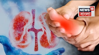 কিডনির স্বাস্থ্যের উপর ইউরিক অ্যাসিড কীভাবে প্রভাব ফেলছে
