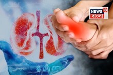 এ যেন এক নীরব ঘাতক! কিডনির স্বাস্থ্যের উপর ইউরিক অ্যাসিড কীভাবে প্রভাব ফেলছে, জানেন কি?