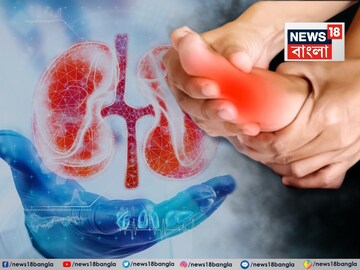কিডনির স্বাস্থ্যের উপর ইউরিক অ্যাসিড কীভাবে প্রভাব ফেলছে