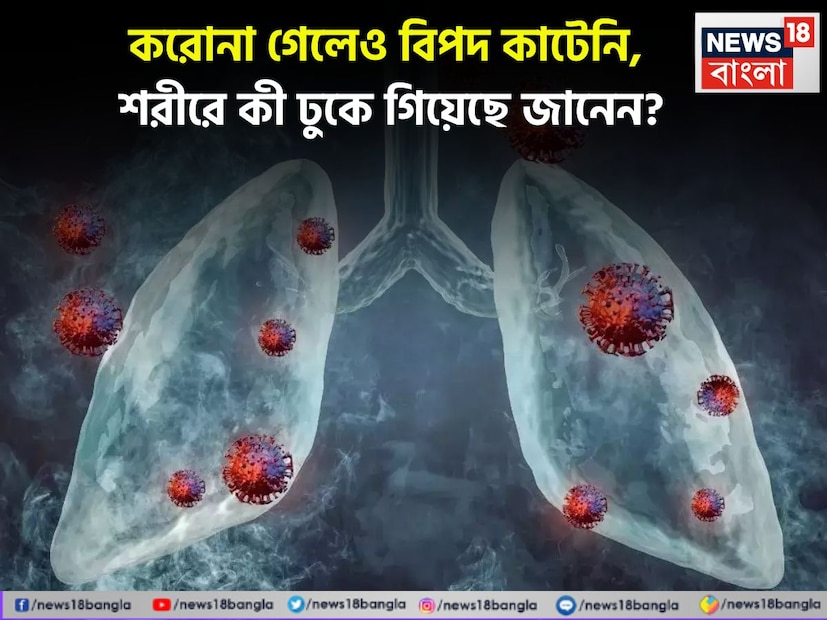 করোনা সংক্রমণের পর থেকে কি দুর্বল হয়ে গিয়েছেন? বার বার অসুস্থ হচ্ছেন? জানেন, কেন হচ্ছে এরকম...যা জানা গেল সম্প্রতি, আঁতকে উঠবেন। বিপদ কেটেছে ভাবছেন? একেবারেই না। Coronavirus Effects after 3 years on people Long term effects of COVID neurological and respiratory risks do you know health-study-says-after pandemic-disorders