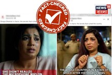 এ কী অবস্থা শ্রেয়া ঘোষালের? মুখে কালশিটে,চোখের তলায় কালি!ভাইরাল ছবি, জানুন আসল খবর