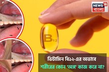 ভিটামিন বি১২-এর অভাবে শরীরের কোন 'অঙ্গ' কাজ করে না? বিপদ বাড়ার আগে খেয়াল করুন এই জিনিস