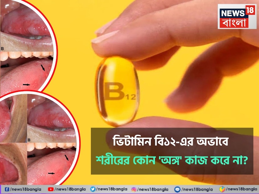 ভিটামিন বি১২-এর অভাবে আপনার শরীরে অনেক রকম সমস্যা দেখা দিতে পারে। অকেজো হতে পারে অঙ্গ। কী কী হবে অভাব দেখা দিলে জেনে নিন। 