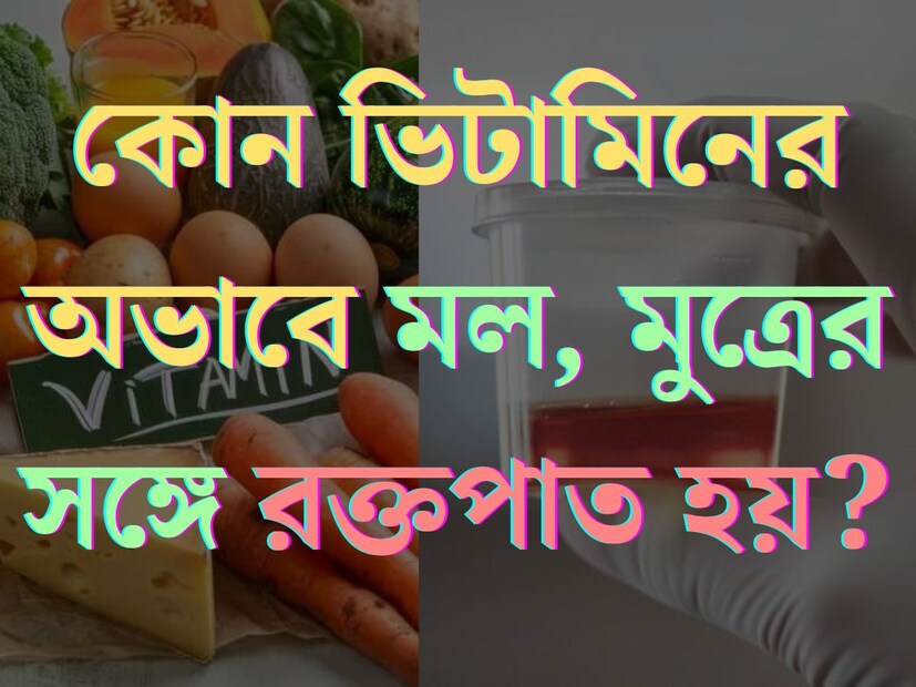 শরীরে সুস্থ রাখতে অত‍্যন্ত জরুরি ভিটামিন এবং খনিজ বা মিনারেলস। দেহে ভিটামিনেক অভাবে দেখা দেয় একাধিক রোগ। হাড়ের বিকাশ থেকে শুরু করে হার্টকে সুস্থ, নিরোগ দেহের অন‍্যতম চাবিকাঠি হল সঠিক পরিমাণ ভিটামিন। 