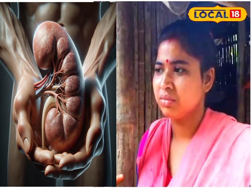 গত কয়েক বছর ধরেই কিডনির সমস্যা ধরা পড়ে তার। নানাভাবে চিকিৎসা করালেও অবশেষে কয়েক সপ্তাহ আগে কলকাতার এক বেসরকারি হাসপাতালের চিকিৎসকরা পরীক্ষা করে জানিয়ে দেন, তার দুটি কিডনি বিকল থাকায় বিকল্প কিডনি বসানো ছাড়া আর কোন উপায় নেই। তার জন্য খরচ প্রায় নয় লক্ষ টাকা। আর্থিকভাবে সামর্থ্য না থাকায় এই ভৌমিক পরিবারকে বাঁচাতে সাহায্যের হাত বাড়িয়ে দিয়েছেন পাড়া-প্রতিবেশী থেকে বন্ধু-বান্ধবরাও। বৌমা নবনীতা ভৌমিক এখন চাইছেন, স্বামীর পাশাপাশি সুস্থভাবেই ফিরুন শ্বশুরও। Input- Rudra Narayan Roy
