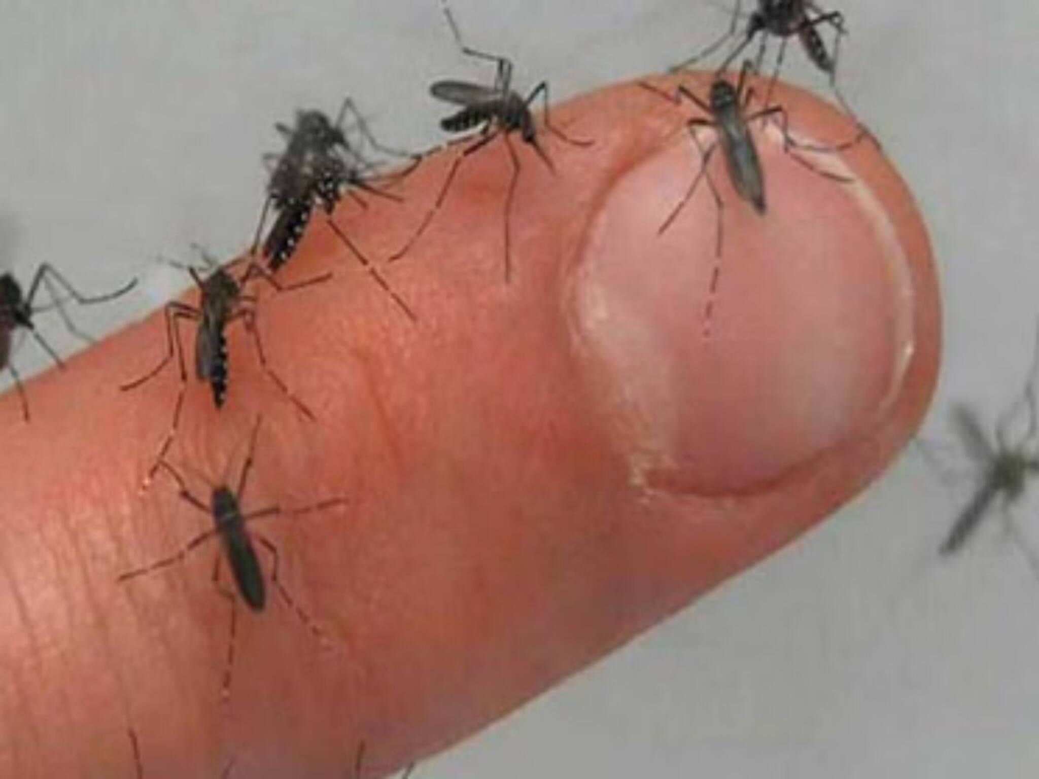 Mosquito Repellent: মশা মারতে কামান নয়, এবার 'মিসাইল সিস্টেম'! তৈরি করলেন এক ভারতীয়, ভিডিও দেখলে চমকে যাবেন!