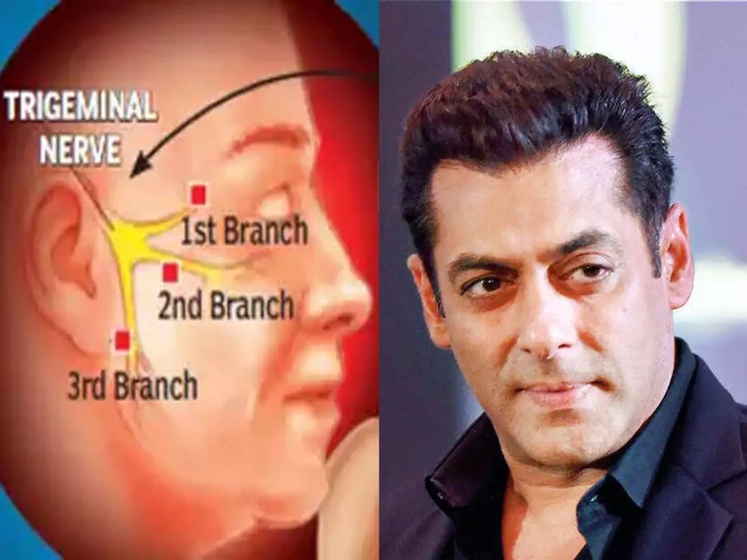 ২০১১ সালে আমেরিকায় অস্ত্রোপচার করান সলমন৷ তার পরে তিনি স্বস্তি পান। সলমন ছাড়াও ব্রিটিশ প্রধানমন্ত্রী উইলিয়াম গ্ল্যাডস্টোন, বিখ্যাত লেখিকা মেলিসা সেমুর এবং আমেরিকান সঙ্গীতশিল্পী এবং কোর্টনি কার্দাশিয়ানের স্বামী ট্র্যাভিস বার্কারও এই রোগের সাথে লড়াই করেছেন।