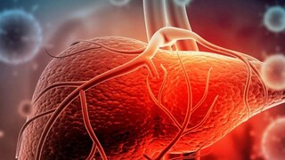 এই ৩টি দৈনন্দিন অভ্যাসই লিভার ক্যানসারের কারণ হতে পারে! জানুন কীভাবে এর থেকে পাবেন রক্ষা...