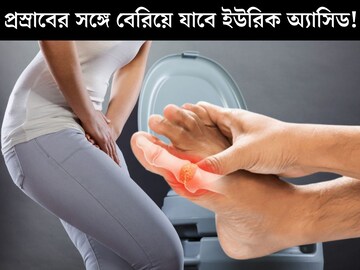 প্রস্রাবের সঙ্গে বেরিয়ে যাবে ইউরিক অ‍্যাসিড! ছেঁকে বের করবে শরীরে জমে থাকা ময়লা, এক পানী