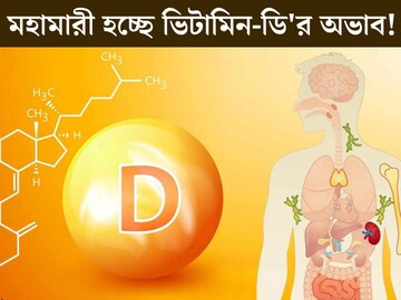 মহামারী হবে ভিটামিন-ডি'র অভাব! ধ্বংস হচ্ছে হার্ট-ব্রেন, আপনার দেহেও কী কম? বাঁচার উপায় কী