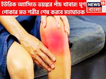 পাঁচ খাবারে শরীর ঝাঁঝরা! ইউরিক অ্যাসিডের তাণ্ডবে ঘূণ পোকার মত কুড়ে কুড়ে শেষ করে