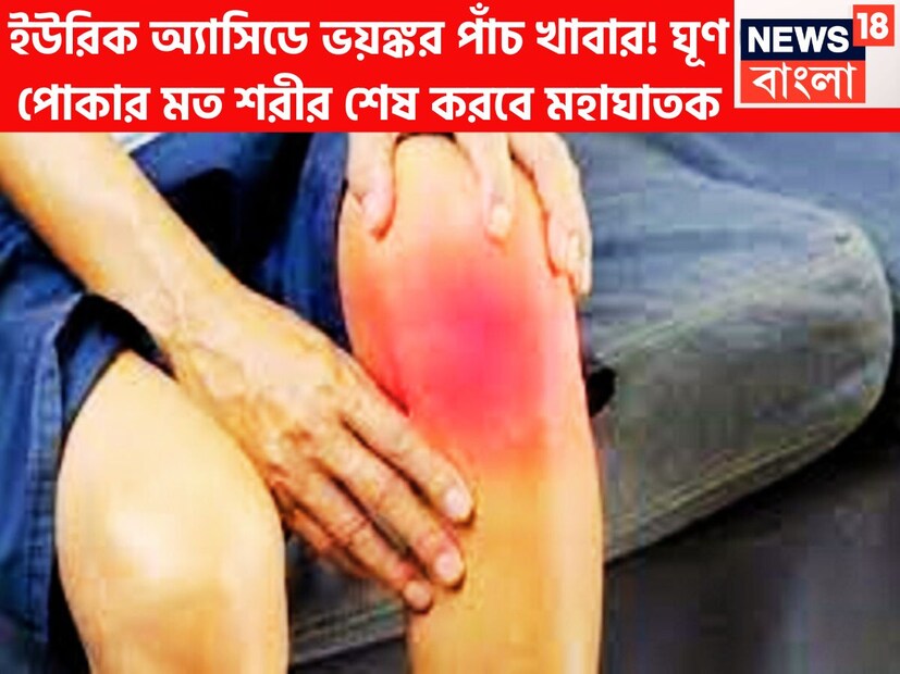 শীতের বাজারে ইউরিক অ্যাসিড ভীষণ পরিমাণে চাপে রাখে ৷ ইউরিক অ্যাসিডের স্তর বৃদ্ধি পেলে ব্যথা যন্ত্রণাও বৃদ্ধি পেয়ে থাকে ৷ এরফলে অসহ্য পরিস্থিতিতে ব্যথা যন্ত্রণা কয়েকগুণ বেড়ে যায় ৷ প্রতীকী ছবি ৷