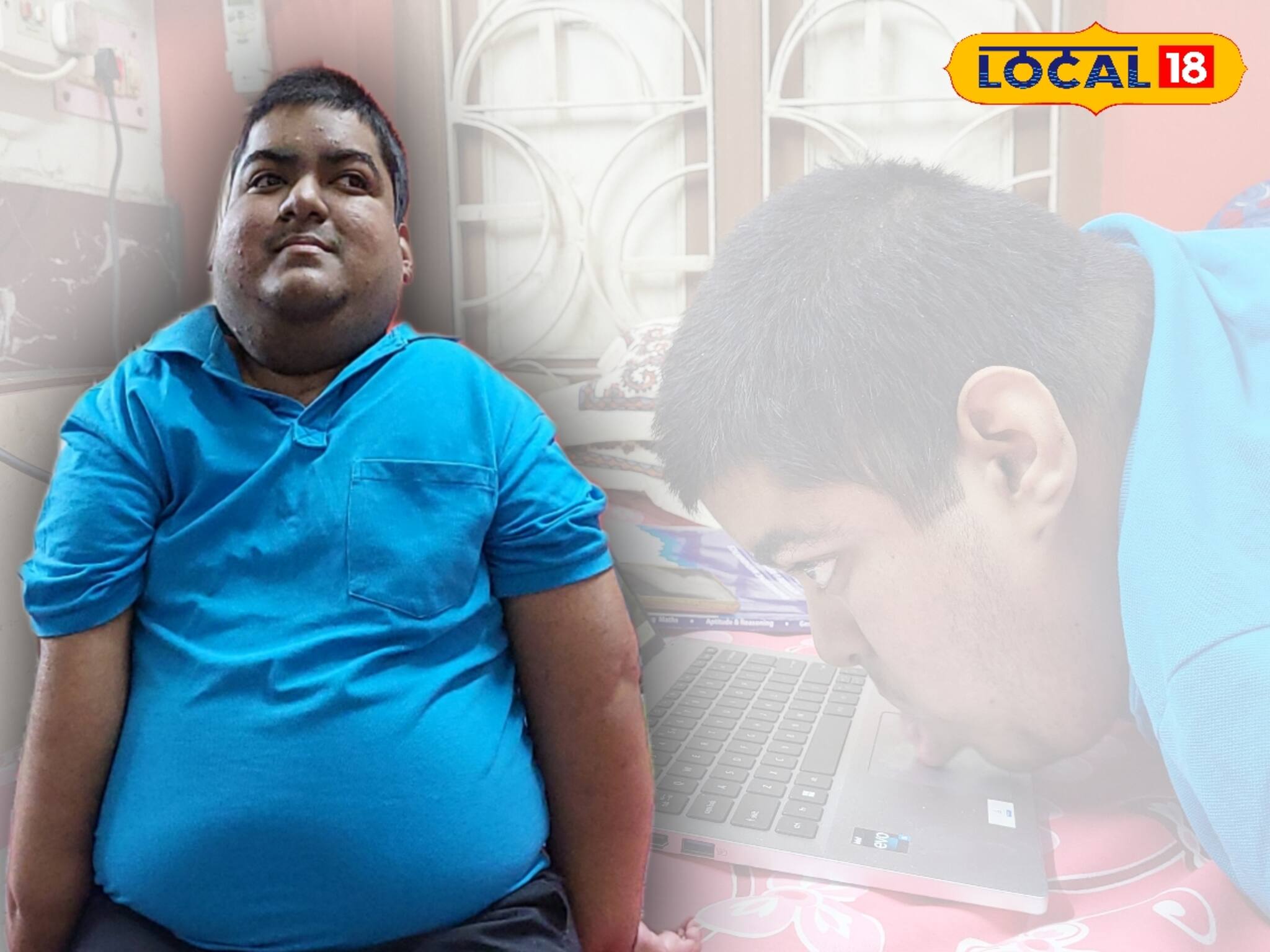 আশৈশব অসাড় হাত-পা, ঠোঁটে কলম ধরে, থুতনি দিয়ে ল্যাপটপ চালিয়েই B.Tech উত্তীর্ণ