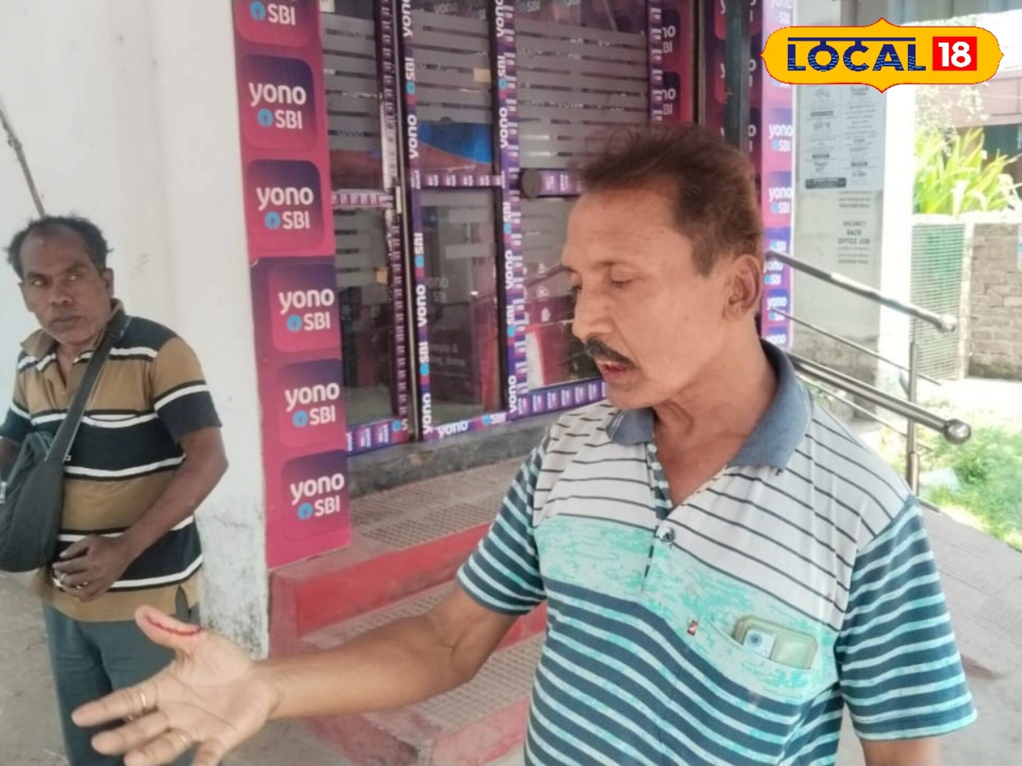 হাতাহাতি নয় কামড়াকামড়ি! পাস বই আপডেট করা নিয়ে বচসা থেকে রক্তারক্তি কান্ড