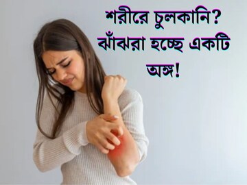 শরীরে বিভিন্ন জায়গায় অসহ‍্য চুলকানি? এড়িয়ে যাবেন না এইসব লক্ষ্মণ! ঝাঁঝরা হচ্ছে এই অঙ্গ