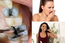 ১ চামচ তেলেই সাফ মুখের পচা গন্ধ! জীবনেও পোকা হবে না দাঁতে! শুধু করুন এটা