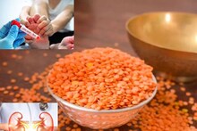 ইউরিক অ্যাসিডের যন্ত্রণায় নাভিশ্বাস! কিডনির দফারফা! মুসুরডালে শরীরের এই ভয়ানক সর্বনাশ হয়