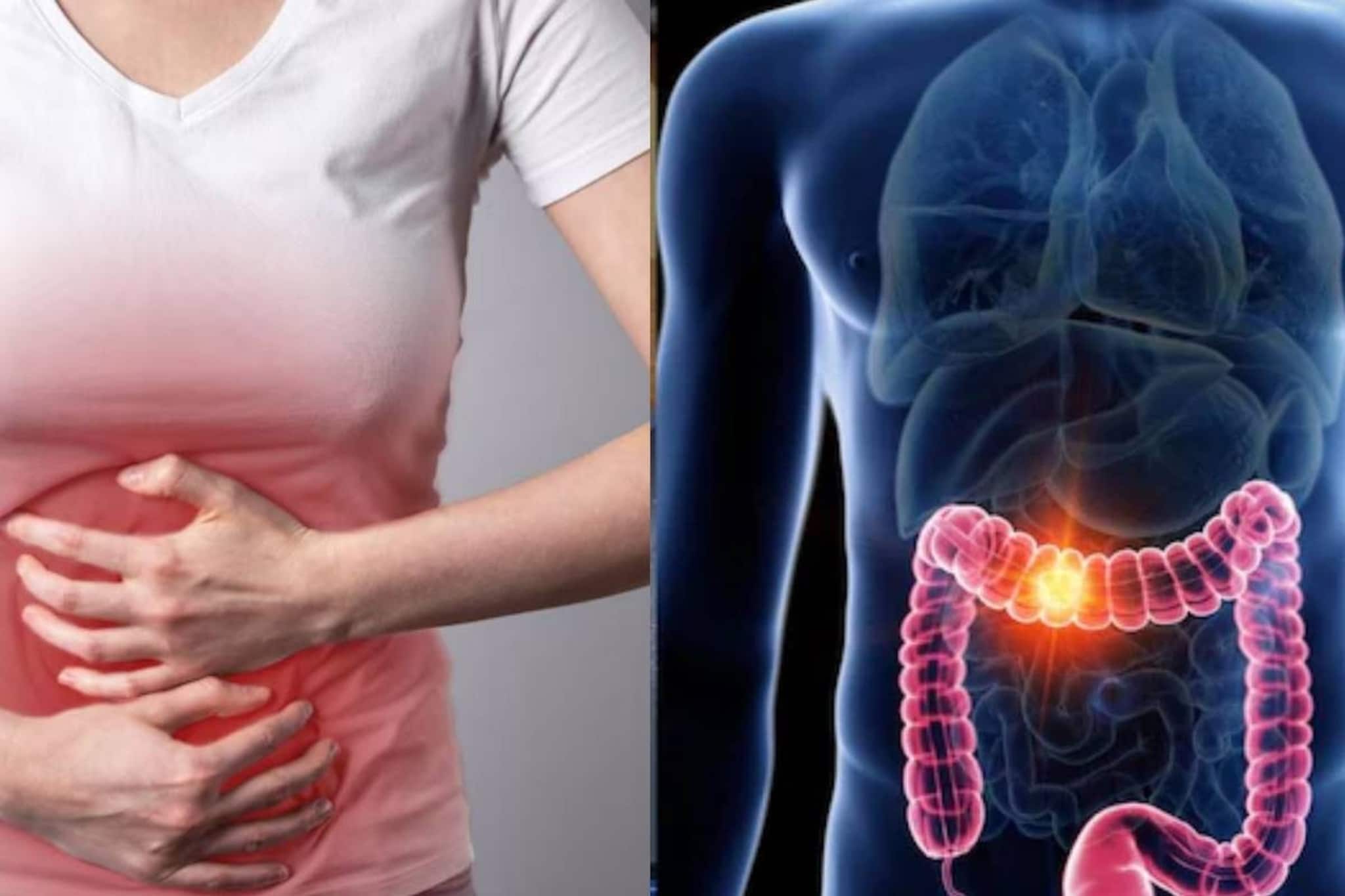 পেটে গেলেই কুরে কুরে 'মানুষের মাংস খায়' এই ডাল! খেলেই ঝাঁঝরা শরীর? দফারফা সব অঙ্গের?