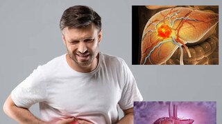 লিভার সুস্থ রাখতে নজর দিন ডায়েটে