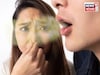 মুখের দুর্গন্ধে লোকে আর পালাবে না! পার্সলে-পুদিনা-মৌরিই করতে পারে সমাধান, ফল তড়িঘড়ি