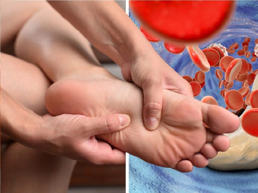 *ইউরিক অ্যাসিড: আমরা যা খাই তা আমাদের শরীরে প্রভাব ফেলে। ভুল খাবার এবং অস্বাস্থ্যকর জীবনযাপনের কারণে অনেকেরই ইউরিক অ্যাসিডের মাত্রা বেড়ে যাওয়ার সমস্যা দেখা দেয়। কিডনি সঠিকভাবে ফিল্টার করতে না পারলে শরীরে ইউরিক অ্যাসিড বেড়ে যায়। তাঁর জেরে জয়েন্টে ব্যথা, ফোলাভাব ইত্যাদি সমস্যা দেখা দিতে পারে। তবে সঠিক খাবার গ্রহণের মাধ্যমে প্রাকৃতিকভাবে এটি নিয়ন্ত্রণ করা যায়। 