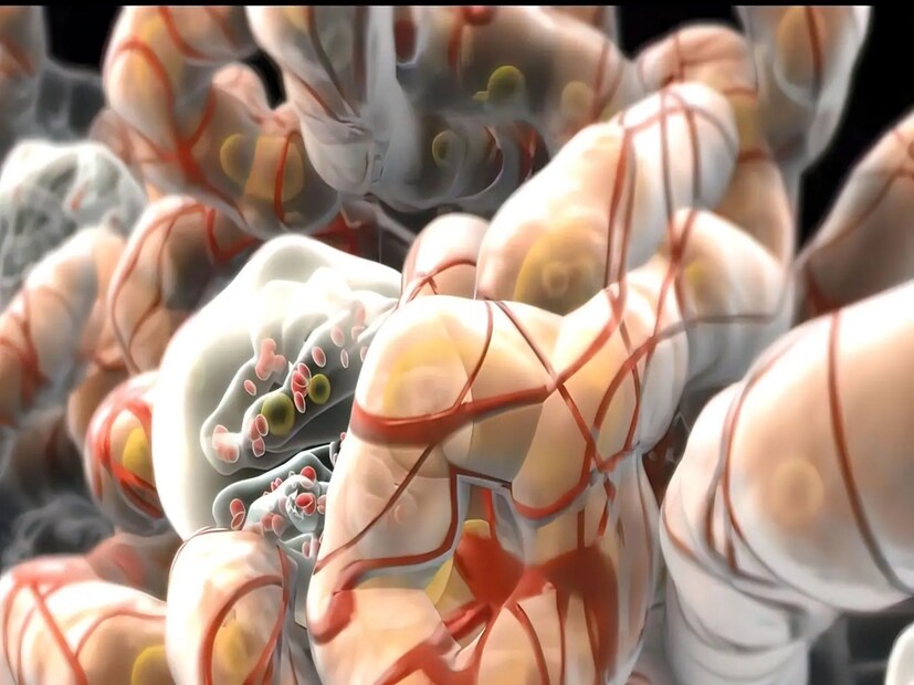 *অ্যালকোহলঃ বিশেষত বিয়ার এবং হুইস্কি ইউরিক অ্যাসিড দ্রুত বাড়িয়ে তুলতে পারে।