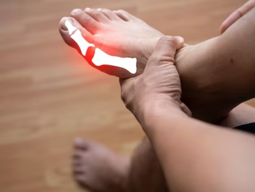 ইউরিক অ্যাসিড শরীর থেকে বেরতে বাধা পেলে জমতে থাক গাঁটগুলিতে। ফলে সেগুলি ফুলতে থাকে। যন্ত্রণাও বাড়তে থাকে। তাছাড়া ইউরিক অ্যাসিড থেকে কিডনি স্টোন ও অন্যান্য জটিলতাও বাড়তে পারে।