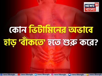 হঠাৎ 'বাঁকা' হতে শুরু করে হাড়...! শরীরে কোন ভিটামিনের অভাবে এমন হয় জানেন? উত্তর জানা জরুরি