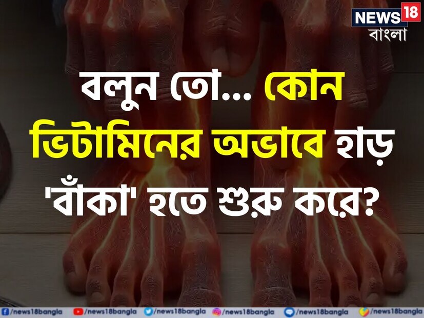 প্রশ্ন ৬ - কোন ভিটামিনের অভাবে হাড় বাঁকা হতে শুরু করে?উত্তর ৬ - মায়ো ক্লিনিকের ওয়েবসাইটে (mayoclinic.org) প্রকাশিত একটি প্রতিবেদন অনুসারে, রিকেটস হল এমন একটি অবস্থা যেখানে শিশুদের হাড় দুর্বল এবং নরম হয়ে যায়, সাধারণত ভিটামিন ডি-এর তীব্র এবং দীর্ঘমেয়াদী অভাবের কারণে এমন হতে পারে। তবে এছাড়া কিছু বিরল জিনগত সমস্যাও রিকেটসের কারণ হতে পারে।