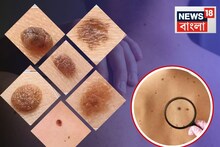 নিঃশব্দে কড়া নাড়ে ক্যানসার...শরীরে এই '৫ লক্ষণ' দেখা দিচ্ছে কি? দেরি হলেই সব শেষ!