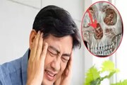 কিছুতেই কমছিল না মাথাব্যথা, ডাক্তারের কাছে যেতেই চক্ষু চড়কগাছ!