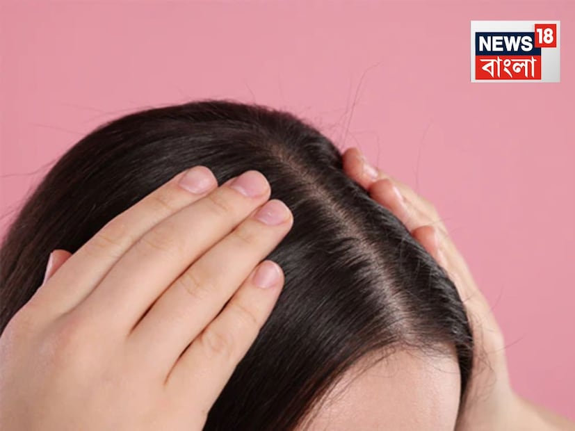 এই সব এড়ানোর উপায় কী?ভাল জল দিয়ে স্নান করুন। সমুদ্র বা সুইমিং পুলের জলে বেশি স্নান করবেন না।চুলে ক্ল্যারিফাইং শ্যাম্পু লাগান। এটি চুল থেকে ক্লোরিন এবং ফ্লোরাইড সম্পূর্ণরূপে অপসারণ করে। সালফেটের পরিমাণ বেশি থাকে এমন শ্যাম্পু ব্যবহার করবেন না। এর পাশাপাশি, শ্যাম্পু লাগানোর পর প্রচুর পরিমাণে কন্ডিশনার ব্যবহার করুন। আপনি যত বেশি কন্ডিশনার ব্যবহার করবেন, তত বেশি সুবিধা পাবেন। এছাড়াও, শ্যাম্পুর পরিবর্তে যদি আপনি আমলকী, শিকাকাই ইত্যাদি প্রাকৃতিক জিনিস ব্যবহার করেন তবে তা আরও ভাল।
