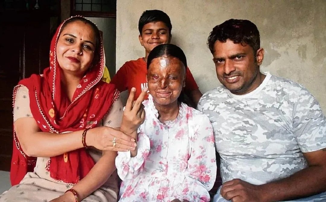 ‘আমার মামলাটা একদিন আমিই লড়তে চাই…’, জানালেন CBSE-তে ৯৫ শতাংশ নম্বর পাওয়া অ্যাসিড আক্রান্ত কাফি ‘আমার মামলাটা একদিন আমিই লড়তে চাই…’, জানালেন CBSE-তে ৯৫ শতাংশ নম্বর পাওয়া অ্যাসিড আক্রান্ত কাফি