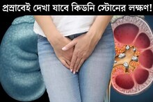 বারবার প্রস্রাবের বেগ? মুত্রের রং...৫ লক্ষণ দেখলেই সতর্ক হয়ে যান! কিডনিতে জমছে পাথর